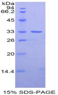 Recombinant Nexilin (NEXN)