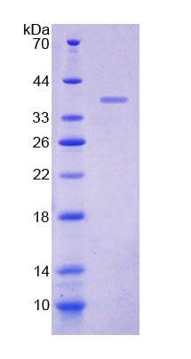 Recombinant Myomesin 2 (MYOM2)