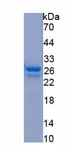 Recombinant Myocilin (MYOC)