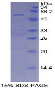 Recombinant Mesothelin (MSLN)