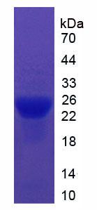 Recombinant Inter Alpha-Globulin Inhibitor H5 (ITIH5)