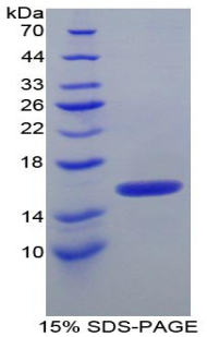 Recombinant Inter Alpha-Globulin Inhibitor H4 (ITIH4)