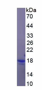 Recombinant Inter Alpha-Globulin Inhibitor H4 (ITIH4)