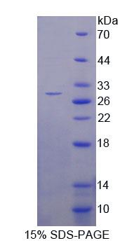 Recombinant Inter Alpha-Globulin Inhibitor H4 (ITIH4)