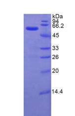 Recombinant Inter Alpha-Globulin Inhibitor H4 (ITIH4)