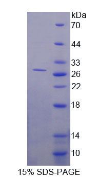 Recombinant DNA Methyltransferase 3B (DNMT3B)