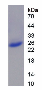 Recombinant Casein Beta (CSN2)