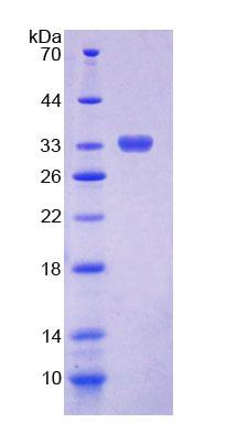 Recombinant Chitinase 1 (CHIT1)