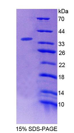 RPJ554Hu01.jpg