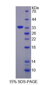 RPJ555Hu01.jpg