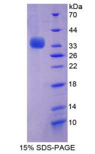 RPJ557Hu01.jpg