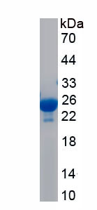 Recombinant Actin Related Protein 2/3 Complex Subunit 5 (ARPC5)