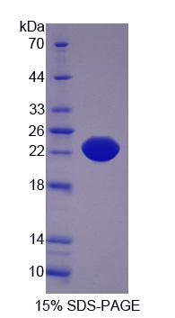 Recombinant Interleukin 21 Receptor (IL21R)