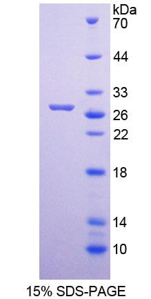 Recombinant MutY Homolog (MUTYH)