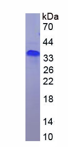 Recombinant Von Hippel Lindau Tumor Suppressor (vHL)