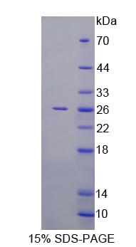 Recombinant RAB1A, Member RAS Oncogene Family (RAB1A)