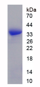 Recombinant Succinate Dehydrogenase Complex Subunit A (SDHA)