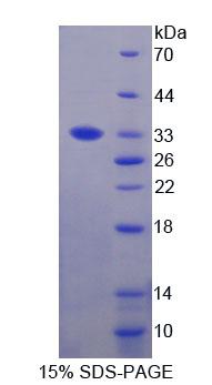 RPJ832Hu01.jpg