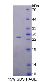 Recombinant Achaete Scute Complex Like Protein 1 (ASCL1)