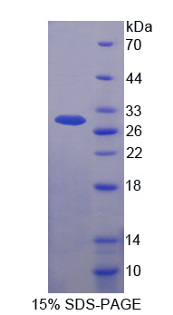 Recombinant F-Box And WD Repeat Domain Containing Protein 7 (FBXW7)