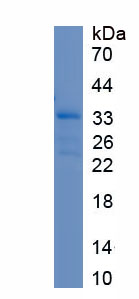 Recombinant Numb Homolog (NUMB)