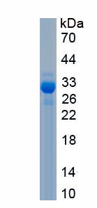 Recombinant DNA Repair Protein RAD50 (RAD50)