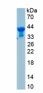 Recombinant Succinate Dehydrogenase Complex Subunit C (SDHC)