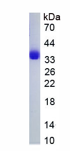 Recombinant RAB7A, Member RAS Oncogene Family (RAB7A)