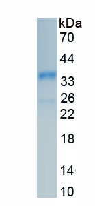 Recombinant Protein Kinase, DNA Activated, Catalytic Polypeptide (PRKDC)