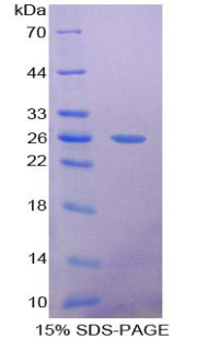 Recombinant Pentraxin 3, Long (PTX3)