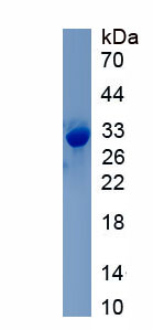 Recombinant PTEN Induced Putative Kinase 1 (PINK1)