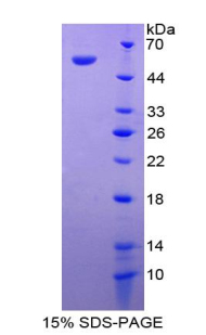 Recombinant Cell Death Inducing DFFA Like Effector A (CIDEA)