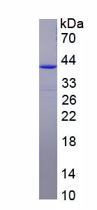 Recombinant ZW10 Interactor (ZWINT)