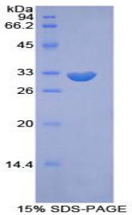 Recombinant Phosphoinositide Kinase, FYVE Finger Containing (PIKFYVE)