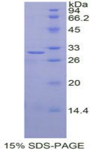 Recombinant Insulin Like Growth Factor 2 mRNA Binding Protein 2 (IGF2BP2)