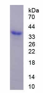 Recombinant Wingless Type MMTV Integration Site Family, Member 3 (WNT3)