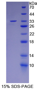 Recombinant NUAK Family SNF1 Like Kinase 1 (NUAK1)