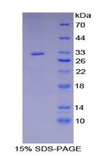 Recombinant Related To Receptor Tyrosine Kinase (RYK)