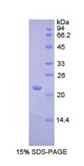 Recombinant RNA Exonuclease 2 Homolog (REXO2)