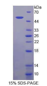 Recombinant Secreted And Transmembrane Protein 1 (SECTM1)