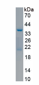 Recombinant Salt Inducible Kinase 2 (SIK2)