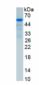 Recombinant Uracil Phosphoribosyltransferase (UPRT)