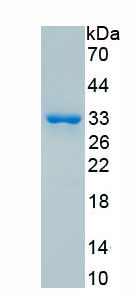 Recombinant Checkpoint Kinase 2 (CHEK2)