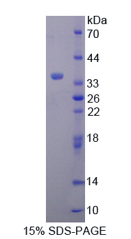 RPP101Hu01.jpg