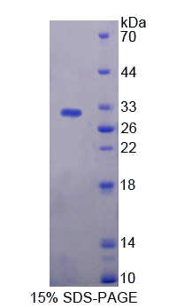 Recombinant Caspase Recruitment Domain Family, Member 9 (CARD9)