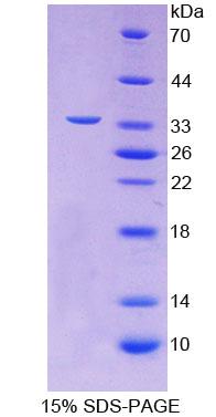 Recombinant Translocase Of Outer Mitochondrial Membrane 70A (TOMM70A)