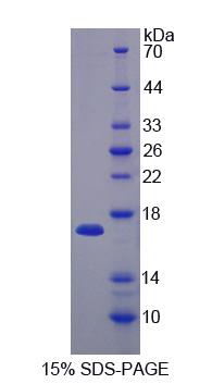 Recombinant SH3 Domain Binding Glutamic Acid Rich Protein Like Protein (SH3BGRL)