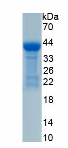 Recombinant Erythroferrone (ERFE)