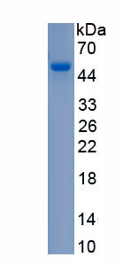 Recombinant Erythroferrone (ERFE)