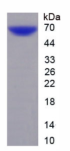 Recombinant Chromosome 22 Open Reading Frame 28 (C22orf28)